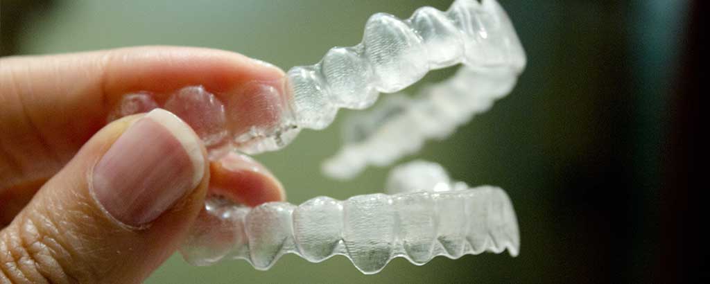 Clear Aligners Creative Smiles